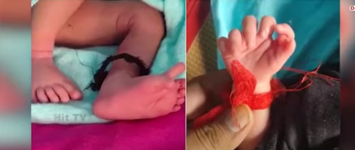 Μωρό στην Ινδία γεννήθηκε με 26 δάχτυλα! (Video)